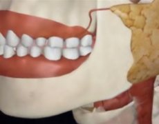 牙疼发朋友圈的句子
